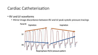 Constrictive Pericarditis: Diagnosis, Pathophysiology and Surgical ...