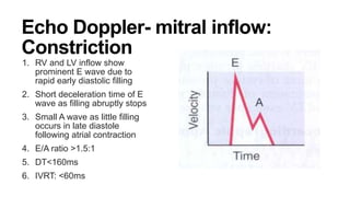Echo Doppler- mitral inflow:
Constriction
1. RV and LV inflow show
prominent E wave due to
rapid early diastolic filling
2. Short deceleration time of E
wave as filling abruptly stops
3. Small A wave as little filling
occurs in late diastole
following atrial contraction
4. E/A ratio >1.5:1
5. DT<160ms
6. IVRT: <60ms
 