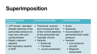 Effusive-constrictive
pericarditis
Constrictive pericarditis Cardiac tamponade
 JVP remain elevated
despite lowering of the
pericardial pressure to
near zero with peri-
cardiocentesis
 Rapid y descent
appears
 No inspiratory decline
in RAP
 Thickened ,scarred
and consequent loss
of the normal elasticity
of the pericardial sac
 Typically chronic
 Variants
 Subacute
 Transient
 occult constriction
 Acute
 Subacute
 Accumulation of
pericardial fluid under
pressure
 Variants
 Low pressure
(occult)
 Regional
tamponade
 
