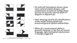 • Pts with left hemisphere leisons show
more coherent block designs, with
maintenance of external configuration
but loss of accurate internal detail 3rd
diagram in adjacent pic.
• Their drawings tend to be simplifications
of the model lacking details but
preserved general spatial relationships
• When pt’s constructional ability is
grossely impaired, in the face of normal
language, right hemisphere dysfunction
is strongly suggested
 