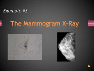 Example #3The Mammogram X-Ray
