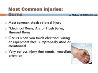 by Melese M. DDU, SCEA
Most Common injuries:
Burns
 Most common shock-related injury
 *Electrical Burns, Arc or Flash Burns,
Thermal Burns
 Occurs when you touch electrical wiring
or equipment that is improperly used or
maintained
 Very serious injury that needs Immediate
attention
 