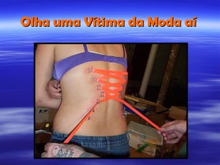 Olha uma Vítima da Moda aí
 
