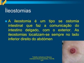 Íleostomias
   A ileostomia é um tipo se ostomia
    intestinal que faz a comunicação do
    intestino delgado, com o exterior. As
    ileostomias localizam-se sempre no lado
    inferior direito do abdómen



                   Trabalho realizado por Mariana
               Liberdade Oliveira Guimarães, nº22108,
                                 UFP
 