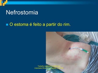 Nefrostomia
   O estoma é feito a partir do rim.




                     Trabalho realizado por Mariana
                 Liberdade Oliveira Guimarães, nº22108,
                                   UFP
 