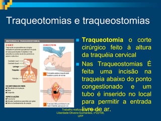 Traqueotomias e traqueostomias
                             Traqueotomia o corte
                              cirúrgico feito à altura
                              da traquéia cervical
                           Nas Traqueostomias É
                              feita uma incisão na
                              traqueia abaixo do ponto
                              congestionado e um
                              tubo é inserido no local
                              para permitir a entrada
                              livre de ar.
              Trabalho realizado por Mariana
          Liberdade Oliveira Guimarães, nº22108,
                   UFP
 