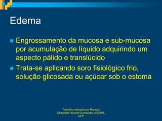 Edema
 Engrossamento da mucosa e sub-mucosa
  por acumulação de líquido adquirindo um
  aspecto pálido e translúcido
 Trata-se aplicando soro fisiológico frio,
  solução glicosada ou açúcar sob o estoma



                  Trabalho realizado por Mariana
              Liberdade Oliveira Guimarães, nº22108,
                                UFP
 