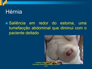 Hérnia
   Saliência em redor do estoma, uma
    tumefacção abdominal que diminui com o
    paciente deitado




                   Trabalho realizado por Mariana
               Liberdade Oliveira Guimarães, nº22108,
                                 UFP
 
