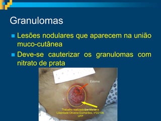Granulomas
 Lesões nodulares que aparecem na união
  muco-cutânea
 Deve-se cauterizar os granulomas com
  nitrato de prata




                Trabalho realizado por Mariana
            Liberdade Oliveira Guimarães, nº22108,
                              UFP
 