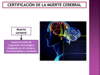 CERTIFICACIÓN DE LA MUERTE CEREBRAL
Ausencia total de
respuesta neurológica
integrada en el cerebro,
troncoencéfalo y cerebelo
Muerte
cerebral
 
