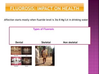 Types of Fluorosis
Dental Skeletal Non skeletal
Affection starts mostly when fluoride level is 3to 8 Mg/Lit in drinking water
 