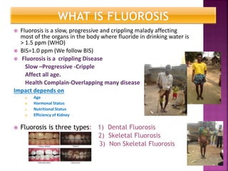 Fluorosis is a slow, progressive and crippling malady affecting
most of the organs in the body where fluoride in drinking water is
> 1.5 ppm (WHO)
 BIS=1.0 ppm (We follow BIS)
 Fluorosis is a crippling Disease
Slow –Progressive -Cripple
Affect all age.
Health Complain-Overlapping many disease
Impact depends on
a. Age
b. Hormonal Status
c. Nutritional Status
d. Efficiency of Kidney
 Fluorosis is three types: 1) Dental Fluorosis
2) Skeletal Fluorosis
3) Non Skeletal Fluorosis
 