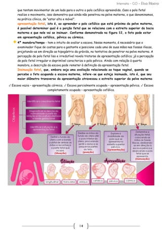 Internato - GO – Elisa Ribeiro
14
que tentam movimentar de um lado para o outro o polo cefálico apreendido. Caso o polo fetal
realize o movimento, isso demonstra que ainda não penetrou na pelve materna, o que denominamos,
na prática clínica, de “estar alto e móvel”.
apresentação fetal, isto é, ao apreender o polo cefálico que está próximo da pelve materna,
é possível determinar qual é a porção fetal que se relaciona com o estreito superior da bacia
materna e que nele vai se insinuar. Conforme demonstrado na figura 12, o feto pode estar
em apresentação cefálica, pélvica ou córmica.
4ª manobra/tempo - tem o intuito de avaliar a escava. Nesse momento, é necessário que o
examinador fique de costas para a gestante e posicione cada uma de suas mãos nas fossas ilíacas,
projetando-as em direção ao hipogástrio da grávida, na tentativa de penetrar na pelve materna. A
percepção de polo fetal liso e irredutível revela tratarse de apresentação cefálica; já a percepção
de polo fetal irregular e deprimível caracteriza o polo pélvico. Ainda com relação à quarta
manobra, a descrição da escava pode remeter à definição da apresentação fetal.
Insinuação fetal, que, embora seja uma avaliação relacionada ao toque vaginal, quando se
percebe o feto ocupando a escava materna, infere-se que esteja insinuado, isto é, que seu
maior diâmetro transverso da apresentação atravessou o estreito superior da pelve materna
✓ Escava vazia – apresentação córmica. ✓ Escava parcialmente ocupada – apresentação pélvica. ✓ Escava
completamente ocupada – apresentação cefálica.
 