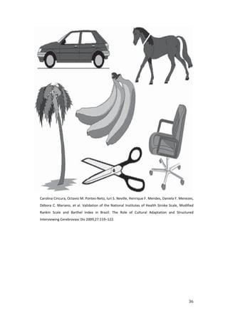Carolina Cincura, Octavio M. Pontes Neto, Iuri S. Neville, Henrique F. Mendes, Daniela F. Menezes,
Débora C. Mariano, et al. Validation of the National Institutes of Health Stroke Scale, Modified
Rankin Scale and Barthel Index in Brazil: The Role of Cultural Adaptation and Structured
Interviewing Cerebrovasc Dis 2009;27:119–122.
 