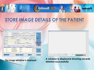 STORE IMAGE DETAILS OF THE PATIENT

The image window is displayed

A window is displayed showing records
deleted successfully

 