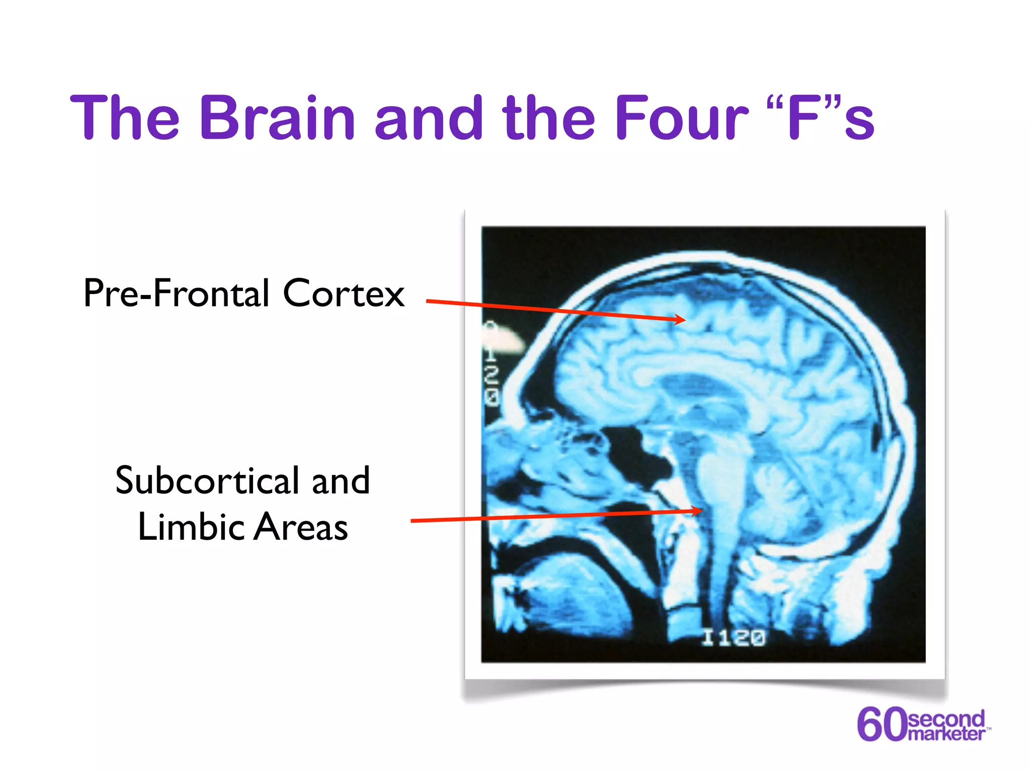 The Brain and the Four “F”s

Pre-Frontal Cortex



 Subcortical and
  Limbic Areas
 