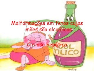 Malformações em fetos cujas mães são alcoólicasCirrose hepática