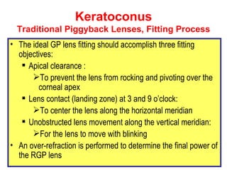 Piggyback Rgp contact lenses fitting for KCN | PPT