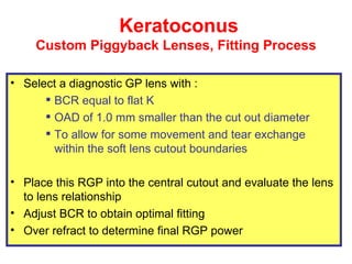 Piggyback Rgp contact lenses fitting for KCN | PPT