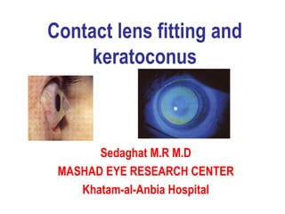 Contact lens fitting and keratoconus Sedaghat M.R M.D MASHAD EYE RESEARCH CENTER Khatam-al-Anbia Hospital 