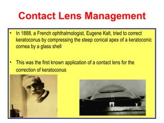 Contact Lens Management <ul><li>In 1888, a French ophthalmologist, Eugene Kalt, tried to correct keratoconus by compressin...
