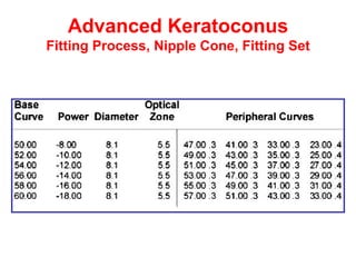Advanced Keratoconus Fitting Process, Nipple Cone, Fitting Set 