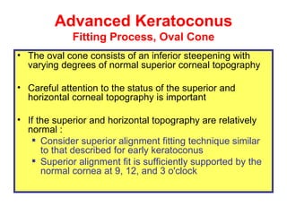 Advanced Keratoconus Fitting Process, Oval Cone <ul><li>The oval  cone consists of  an inferior steepening with varying de...