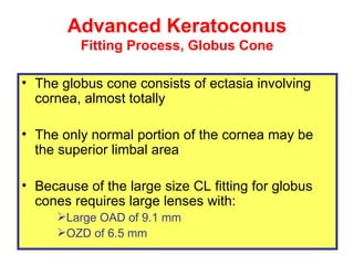 Advanced Keratoconus Fitting Process, Globus Cone <ul><li>The globus  cone consists of  ectasia  involving  cornea , almos...