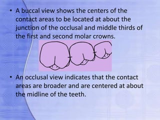 • A buccal view shows the centers of the
contact areas to be located at about the
junction of the occlusal and middle thirds of
the first and second molar crowns.
• An occlusal view indicates that the contact
areas are broader and are centered at about
the midline of the teeth.
 
