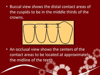 • Buccal view shows the distal contact areas of
the cuspids to be in the middle thirds of the
crowns.
• An occlusal view shows the centers of the
contact areas to be located at approximately
the midline of the teeth.
 