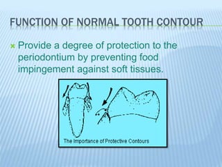 FUNCTION OF NORMAL TOOTH CONTOUR
 Provide a degree of protection to the
periodontium by preventing food
impingement against soft tissues.
 