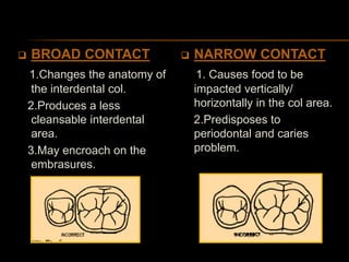 BROAD CONTACT
1.Changes the anatomy of
the interdental col.
2.Produces a less
cleansable interdental
area.
3.May encroach on the
embrasures.
 NARROW CONTACT
1. Causes food to be
impacted vertically/
horizontally in the col area.
2.Predisposes to
periodontal and caries
problem.
 