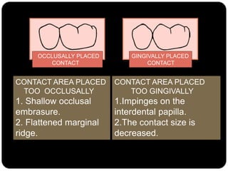 OCCLUSALLY PLACED
CONTACT
GINGIVALLY PLACED
CONTACT
CONTACT AREA PLACED
TOO GINGIVALLY
1.Impinges on the
interdental papilla.
2.The contact size is
decreased.
CONTACT AREA PLACED
TOO OCCLUSALLY
1. Shallow occlusal
embrasure.
2. Flattened marginal
ridge.
 