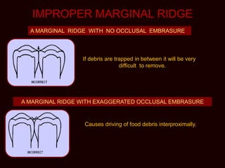 IMPROPER MARGINAL RIDGE
A MARGINAL RIDGE WITH NO OCCLUSAL EMBRASURE
A MARGINAL RIDGE WITH EXAGGERATED OCCLUSAL EMBRASURE
Causes driving of food debris interproximally.
If debris are trapped in between it will be very
difficult to remove.
 