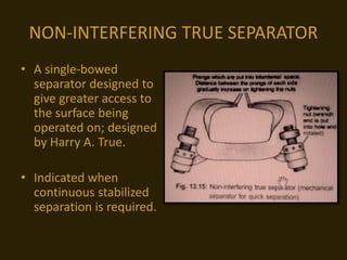 NON-INTERFERING TRUE SEPARATOR
• A single-bowed
separator designed to
give greater access to
the surface being
operated on; designed
by Harry A. True.
• Indicated when
continuous stabilized
separation is required.
 