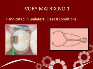 IVORY MATRIX NO.1
• Indicated in unilateral Class II conditions.
 