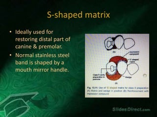 S-shaped matrix
• Ideally used for
restoring distal part of
canine & premolar.
• Normal stainless steel
band is shaped by a
mouth mirror handle.
 