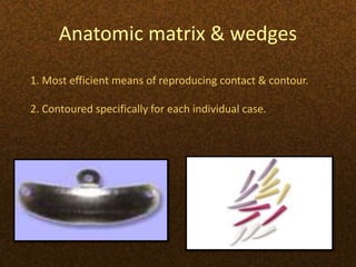 Anatomic matrix & wedges
1. Most efficient means of reproducing contact & contour.
2. Contoured specifically for each individual case.
 
