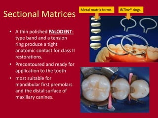 Sectional Matrices
• A thin polished PALODENT-
type band and a tension
ring produce a tight
anatomic contact for class II
restorations.
• Precontoured and ready for
application to the tooth
• most suitable for
mandibular first premolars
and the distal surface of
maxillary canines.
BiTine® ringsMetal matrix forms
 