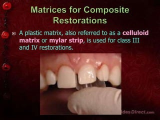 A plastic matrix, also referred to as a celluloid
matrix or mylar strip, is used for class III
and IV restorations.
 