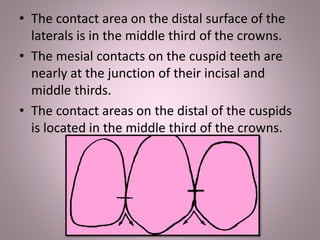 • The contact area on the distal surface of the
laterals is in the middle third of the crowns.
• The mesial contacts on the cuspid teeth are
nearly at the junction of their incisal and
middle thirds.
• The contact areas on the distal of the cuspids
is located in the middle third of the crowns.
 