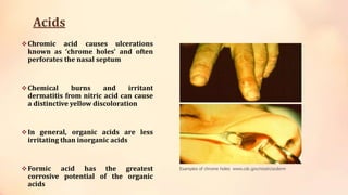 Acids
Chromic acid causes ulcerations
known as ‘chrome holes’ and often
perforates the nasal septum
Chemical burns and irritant
dermatitis from nitric acid can cause
a distinctive yellow discoloration
In general, organic acids are less
irritating than inorganic acids
Formic acid has the greatest
corrosive potential of the organic
acids
Examples of chrome holes www.cdc.gov/niosh/ocderm
 