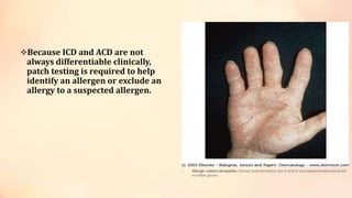 Because ICD and ACD are not
always differentiable clinically,
patch testing is required to help
identify an allergen or exclude an
allergy to a suspected allergen.
 Allergic contact dermatitis. Chronic hand dermatitis due to ACD to mercaptobenzothiazole found
in rubber gloves
 