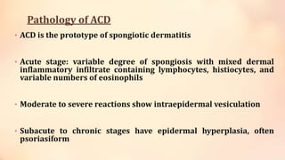 Pathology of ACD
• ACD is the prototype of spongiotic dermatitis
• Acute stage: variable degree of spongiosis with mixed dermal
inflammatory infiltrate containing lymphocytes, histiocytes, and
variable numbers of eosinophils
• Moderate to severe reactions show intraepidermal vesiculation
• Subacute to chronic stages have epidermal hyperplasia, often
psoriasiform
 