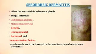 SEBORRHEIC DERMATITIS
• affect the areas rich in sebaceous glands
• Fungal infection:
• Malassezia globosa ,
• Malassezia restricta
• Genetic,
• environmental,
• hormonal, and
immune-system factors
have been shown to be involved in the manifestation of seborrhoeic
dermatitis
 