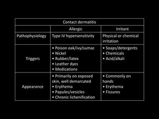 Contact dermatitis
Allergic Irritant
Pathophysiology Type IV hypersensitivity Physical or chemical
irritation
Triggers
• Poison oak/ivy/sumac
• Nickel
• Rubber/latex
• Leather dyes
• Medications
• Soaps/detergents
• Chemicals
• Acid/alkali
Appearance
• Primarily on exposed
skin, well demarcated
• Erythema
• Papules/vesicles
• Chronic lichenification
• Commonly on
hands
• Erythema
• Fissures
 