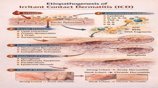 Contact dermatitis-etiopathogenesisandclassificatio | PPTX