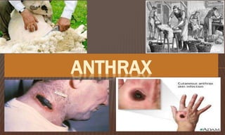 ANTHRAX
 