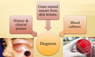 Diagnosis
History &
clinical
picture
Gram stained
smears from
skin lesions.
Blood
cultures.
 