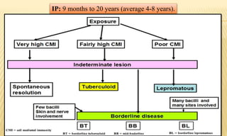 IP: 9 months to 20 years (average 4-8 years).
 